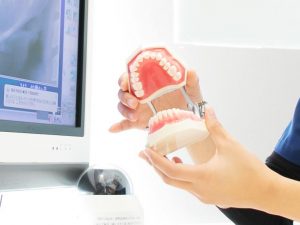 歯の模型を使って骨造成について説明してる女性歯科医師